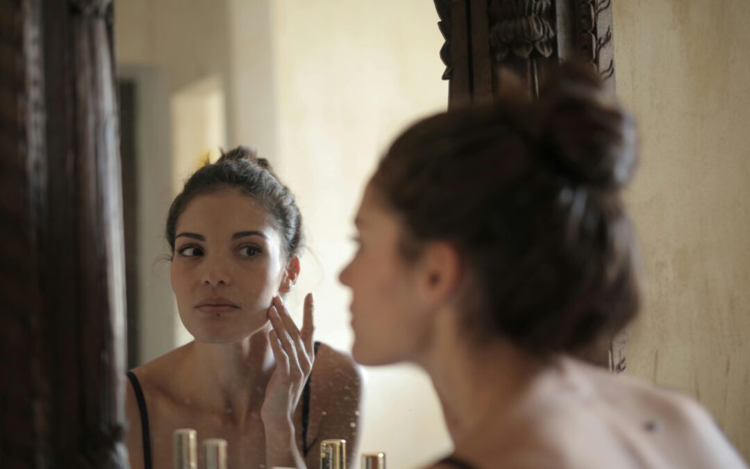 How to Treat Acne Naturally (Without Harsh Chemicals)