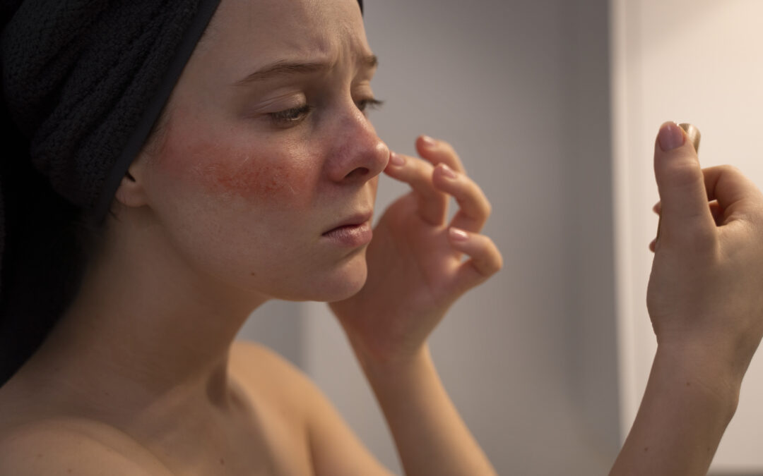 Best Skincare Routine for Sensitive Skin