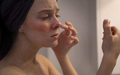 Best Skincare Routine for Sensitive Skin